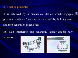 2. Traction principle:

It is achieved by a mechanical device which engages
proximal surface of teeth to be separated by holding arms
and then separation is achieved.

Ex: Non interfering true separator, Ferrior double bow
separator.
 