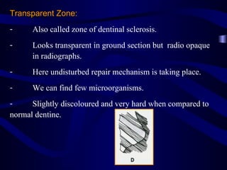 Transparent Zone:
-     Also called zone of dentinal sclerosis.
-     Looks transparent in ground section but radio opaque
      in radiographs.
-     Here undisturbed repair mechanism is taking place.
-     We can find few microorganisms.
-     Slightly discoloured and very hard when compared to
normal dentine.
 