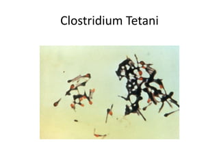 Tetanus !! | PPTX