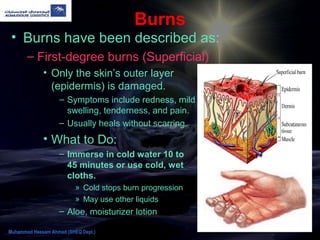 Burns
• Burns have been described as:
– First-degree burns (Superficial)
• Only the skin’s outer layer
(epidermis) is damaged.
– Symptoms include redness, mild
swelling, tenderness, and pain.
– Usually heals without scarring.
• What to Do:
– Immerse in cold water 10 to
45 minutes or use cold, wet
cloths.
» Cold stops burn progression
» May use other liquids
– Aloe, moisturizer lotion
Muhammad Hassam Ahmad (SHEQ Dept.)
 