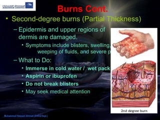 Burns Cont.
• Second-degree burns (Partial Thickness)
– Epidermis and upper regions of
dermis are damaged.
• Symptoms include blisters, swelling,
weeping of fluids, and severe pain.
– What to Do:
• Immerse in cold water / wet pack
• Aspirin or ibuprofen
• Do not break blisters
• May seek medical attention
Muhammad Hassam Ahmad (SHEQ Dept.)
 