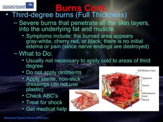 Burns Cont.
• Third-degree burns (Full Thickness)
– Severe burns that penetrate all the skin layers,
into the underlying fat and muscle.
• Symptoms include: the burned area appears
gray-white, cherry red, or black; there is no initial
edema or pain (since nerve endings are destroyed)
– What to Do:
• Usually not necessary to apply cold to areas of third
degree
• Do not apply ointments
• Apply sterile, non-stick
dressings (do not use
plastic)
• Check ABC’s
• Treat for shock
• Get medical help
Muhammad Hassam Ahmad (SHEQ Dept.)
 
