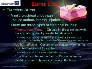Burns Cont.
• Electrical Burns
– A mild electrical shock can
cause serious internal injuries.
– There are three types of electrical injuries:
• Thermal burn (flame) – Objects in direct contact with
the skin are ignited by an electrical current.
– Mostly caused by the flames produced by the electrical
current and not by the passage of the electrical current or arc.
• Arc burn (Flash) – Occurs when electricity jumps, or
arcs, from one spot to another.
– Mostly cause extensive superficial injuries.
• True Electrical Injury (contact) – Occurs when an
electric current truly passes through the body.
Muhammad Hassam Ahmad (SHEQ Dept.)
 