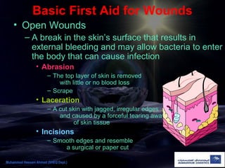 Basic First Aid for Wounds
• Open Wounds
– A break in the skin’s surface that results in
external bleeding and may allow bacteria to enter
the body that can cause infection
• Abrasion
– The top layer of skin is removed
with little or no blood loss
– Scrape
• Laceration
– A cut skin with jagged, irregular edges
and caused by a forceful tearing away
of skin tissue
• Incisions
– Smooth edges and resemble
a surgical or paper cut
Muhammad Hassam Ahmad (SHEQ Dept.)
 