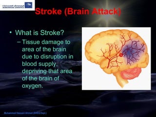 Stroke (Brain Attack)
• What is Stroke?
– Tissue damage to
area of the brain
due to disruption in
blood supply,
depriving that area
of the brain of
oxygen.
Muhammad Hassam Ahmad (SHEQ Dept.)
 
