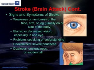 Stroke (Brain Attack) Cont.
• Signs and Symptoms of Stroke:
– Weakness or numbness of the
face, arm, or leg (usually on one
side of the body)
– Blurred or decreased vision,
especially in one eye.
– Problems speaking or understanding
– Unexplained, severe headache
– Dizziness, unsteadiness,
or sudden fall
Muhammad Hassam Ahmad (SHEQ Dept.)
 
