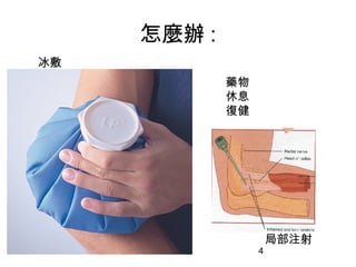 4
怎麼辦 :
冰敷
藥物
休息
復健
局部注射
 