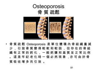 81
Osteoporosis
骨 質 疏鬆
• 骨 質 疏 鬆 Osteoporosis 是 單 位 體 積 內 骨 組 織 量 減
少 ， 引 致 骨 質 變 得 較 軟 和 較 弱 ， 但 存 在 的 骨 組
織 有 正 常 的 鈣 化 ， 一 般 鈣 鹽 和 基 質 呈 正 常 比 例
。 這 是 年 紀 老 化 時 一 個 必 然 現 象 ，亦 可 由 於 骨
質 吸 收 增 多 而 引 致 。
 