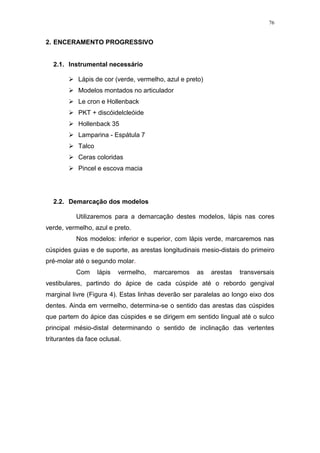 76
2. ENCERAMENTO PROGRESSIVO
2.1. Instrumental necessário
 Lápis de cor (verde, vermelho, azul e preto)
 Modelos montados no articulador
 Le cron e Hollenback
 PKT + discóidelcleóide
 Hollenback 35
 Lamparina - Espátula 7
 Talco
 Ceras coloridas
 Pincel e escova macia
2.2. Demarcação dos modelos
Utilizaremos para a demarcação destes modelos, lápis nas cores
verde, vermelho, azul e preto.
Nos modelos: inferior e superior, com lápis verde, marcaremos nas
cúspides guias e de suporte, as arestas longitudinais mesio-distais do primeiro
pré-molar até o segundo molar.
Com lápis vermelho, marcaremos as arestas transversais
vestibulares, partindo do ápice de cada cúspide até o rebordo gengival
marginal livre (Figura 4). Estas linhas deverão ser paralelas ao longo eixo dos
dentes. Ainda em vermelho, determina-se o sentido das arestas das cúspides
que partem do ápice das cúspides e se dirigem em sentido lingual até o sulco
principal mésio-distal determinando o sentido de inclinação das vertentes
triturantes da face oclusal.
 