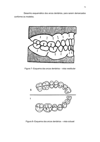 79
Desenho esquemático dos arcos dentários, para serem demarcados
conforme os modelos.
Figura 7- Esquema dos arcos dentários – vista vestibular
Figura 8- Esquema dos arcos dentários – vista oclusal
 