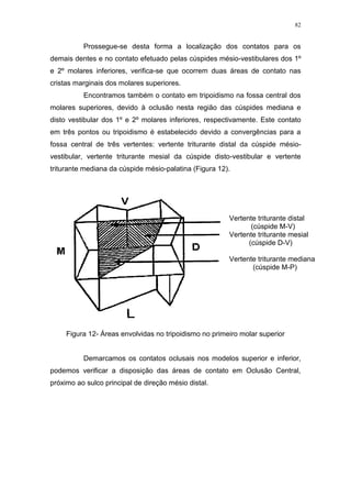 82
Prossegue-se desta forma a localização dos contatos para os
demais dentes e no contato efetuado pelas cúspides mésio-vestibulares dos 1º
e 2º molares inferiores, verifica-se que ocorrem duas áreas de contato nas
cristas marginais dos molares superiores.
Encontramos também o contato em tripoidismo na fossa central dos
molares superiores, devido à oclusão nesta região das cúspides mediana e
disto vestibular dos 1º e 2º molares inferiores, respectivamente. Este contato
em três pontos ou tripoidismo é estabelecido devido a convergências para a
fossa central de três vertentes: vertente triturante distal da cúspide mésio-
vestibular, vertente triturante mesial da cúspide disto-vestibular e vertente
triturante mediana da cúspide mésio-palatina (Figura 12).
Figura 12- Áreas envolvidas no tripoidismo no primeiro molar superior
Demarcamos os contatos oclusais nos modelos superior e inferior,
podemos verificar a disposição das áreas de contato em Oclusão Central,
próximo ao sulco principal de direção mésio distal.
Vertente triturante distal
(cúspide M-V)
Vertente triturante mesial
(cúspide D-V)
Vertente triturante mediana
(cúspide M-P)
 