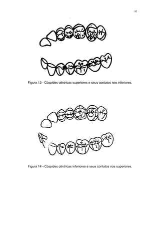 83
Figura 13 - Cúspides cêntricas superiores e seus contatos nos inferiores.
Figura 14 - Cúspides cêntricas inferiores e seus contatos nos superiores.
 