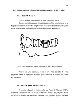 84
2.4. ENCERAMENTO PROGRESSIVO - PASSOS (36, 12, 21, 23 e 27)
2.4.1. DESGASTE DO 36
Com o Le Cron desgasta-se o 36 até a metade da coroa.
Sobre a superfície oclusal desgastada do modelo, complementa-se o
traçado, localizando as arestas longitudinal e transversal de cada cúspide, para
situar seus vértices, orientando-se pelos dentes vizinhos (Figura 15).
Figura 15 - Desgaste do dente para realização do enceramento.
Através de uma espátula, passa-se uma fina camada de cera
pegajosa sobre a superfície recortada para melhorar a fixação do futuro
enceramento.
2.4.2. LEVANTAMENTO DOS CONES
A seguir, utilizando o instrumental de Peter K. Thomas (PKT),
iniciamos o levantamento dos cones vestibulares através do gotejador duplo
aquecido na chama da lamparina, colhendo uma pequena porção de cera
 