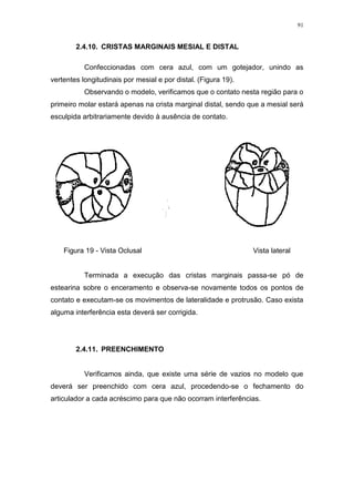 91
2.4.10. CRISTAS MARGINAIS MESIAL E DISTAL
Confeccionadas com cera azul, com um gotejador, unindo as
vertentes longitudinais por mesial e por distal. (Figura 19).
Observando o modelo, verificamos que o contato nesta região para o
primeiro molar estará apenas na crista marginal distal, sendo que a mesial será
esculpida arbitrariamente devido à ausência de contato.
Figura 19 - Vista Oclusal Vista lateral
Terminada a execução das cristas marginais passa-se pó de
estearina sobre o enceramento e observa-se novamente todos os pontos de
contato e executam-se os movimentos de lateralidade e protrusão. Caso exista
alguma interferência esta deverá ser corrigida.
2.4.11. PREENCHIMENTO
Verificamos ainda, que existe uma série de vazios no modelo que
deverá ser preenchido com cera azul, procedendo-se o fechamento do
articulador a cada acréscimo para que não ocorram interferências.
 