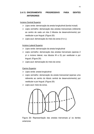 94
2.4.13. ENCERAMENTO PROGRESSIVO PARA DENTES
ANTERIORES
Incisivo Central Superior
 Lápis verde: demarcação da aresta longitudinal (borda incisal)
 Lápis vermelho: demarcação das arestas transversais (referente
ao centro de cada um dos 3 lóbulos de desenvolvimento) por
vestibular e por lingual. (Figura 20)
 Lápis azul: demarcação do meio da coroa (V e L)
Incisivo Lateral Superior
 Lápis verde: demarcação da aresta longitudinal
 Lápis vermelho: demarcação das arestas tranversais (apenas 2
p/ o incisivo lateral, nos lóbulos M e D) por vestibular e por
lingual. (Figura 20)
 Lápis azul: demarcação do meio da coroa
Canino Superior
 Lápis verde: aresta longitudinal
 Lápis vermelho: demarcação da aresta transversal (apenas uma
referente ao centro do lóbulo central de desenvolvimento) por
vestibular e por lingual. (Figura 20)
 Lápis azul: meio da coroa.
Figura 20- Representação das arestas tranversais p/ os dentes
anteriores
 