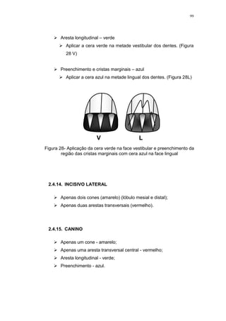 99
 Aresta longitudinal – verde
 Aplicar a cera verde na metade vestibular dos dentes. (Figura
28 V)
 Preenchimento e cristas marginais – azul
 Aplicar a cera azul na metade lingual dos dentes. (Figura 28L)
2.4.14. INCISIVO LATERAL
 Apenas dois cones (amarelo) (lóbulo mesial e distal);
 Apenas duas arestas transversais (vermelho).
2.4.15. CANINO
 Apenas um cone - amarelo;
 Apenas uma aresta transversal central - vermelho;
 Aresta longitudinal - verde;
 Preenchimento - azul.
V L
Figura 28- Aplicação da cera verde na face vestibular e preenchimento da
região das cristas marginais com cera azul na face lingual
 