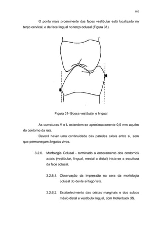 102
O ponto mais proeminente das faces vestibular está localizado no
terço cervical, e da face lingual no terço oclusal (Figura 31).
Figura 31- Bossa vestibular e lingual
As curvaturas V e L estendem-se aproximadamente 0,5 mm aquém
do contorno da raiz.
Deverá haver uma continuidade das paredes axiais entre si, sem
que permaneçam ângulos vivos.
3.2.6. Morfologia Oclusal - terminado o enceramento dos contornos
axiais (vestibular, lingual, mesial a distal) inicia-se a escultura
da face oclusal.
3.2.6.1. Observação da impressão na cera da morfologia
oclusal do dente antagonista.
3.2.6.2. Estabelecimento das cristas marginais e dos sulcos
mésio distal e vestíbulo lingual, com Hollenback 3S.
 