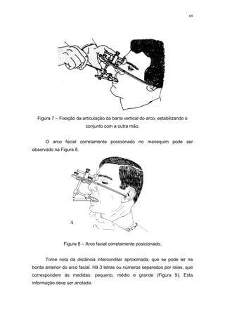 68
Figura 7 – Fixação da articulação da barra vertical do arco, estabilizando o
conjunto com a outra mão.
O arco facial corretamente posicionado no manequim pode ser
observado na Figura 8.
Figura 8 – Arco facial corretamente posicionado.
Tome nota da distância intercondilar aproximada, que se pode ler na
borda anterior do arco facial. Há 3 letras ou números separados por raias, que
correspondem às medidas: pequeno, médio e grande (Figura 9). Esta
informação deve ser anotada.
 