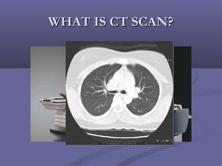 WHAT IS CT SCAN?WHAT IS CT SCAN?
 