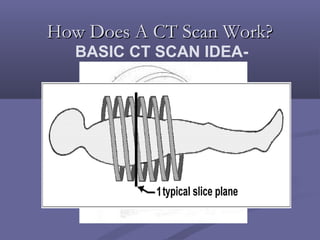 How Does A CT Scan Work?How Does A CT Scan Work?
-BASIC CT SCAN IDEA
 