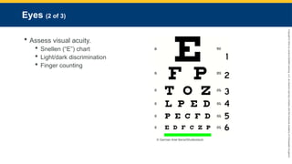 Copyright
©
2023
by
Jones
&
Bartlett
Learning,
LLC,
an
Ascend
Learning
Company
and
the
American
Academy
of
Orthopaedic
Surgeons.
Eyes (2 of 3)
 Assess visual acuity.
 Snellen (“E”) chart
 Light/dark discrimination
 Finger counting
© German Ariel Berra/Shutterstock.
 