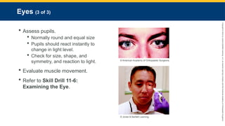 Copyright
©
2023
by
Jones
&
Bartlett
Learning,
LLC,
an
Ascend
Learning
Company
and
the
American
Academy
of
Orthopaedic
Surgeons.
Eyes (3 of 3)
 Assess pupils.
 Normally round and equal size
 Pupils should react instantly to
change in light level.
 Check for size, shape, and
symmetry, and reaction to light.
 Evaluate muscle movement.
 Refer to Skill Drill 11-6:
Examining the Eye.
© American Academy of Orthopaedic Surgeons.
© Jones & Bartlett Learning.
 