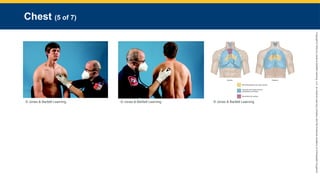 Copyright
©
2023
by
Jones
&
Bartlett
Learning,
LLC,
an
Ascend
Learning
Company
and
the
American
Academy
of
Orthopaedic
Surgeons.
Chest (5 of 7)
© Jones & Bartlett Learning. © Jones & Bartlett Learning. © Jones & Bartlett Learning.
 
