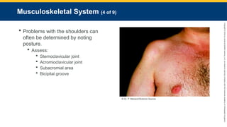 Copyright
©
2023
by
Jones
&
Bartlett
Learning,
LLC,
an
Ascend
Learning
Company
and
the
American
Academy
of
Orthopaedic
Surgeons.
Musculoskeletal System (4 of 9)
 Problems with the shoulders can
often be determined by noting
posture.
 Assess:
 Sternoclavicular joint
 Acromioclavicular joint
 Subacromial area
 Bicipital groove
© Dr. P. Marazzi/Science Source.
 