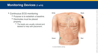 Copyright
©
2023
by
Jones
&
Bartlett
Learning,
LLC,
an
Ascend
Learning
Company
and
the
American
Academy
of
Orthopaedic
Surgeons.
Monitoring Devices (1 of 6)
 Continuous ECG monitoring
 Purpose is to establish a baseline.
 Electrodes must be placed
properly.
 The leads are usually colored and
labeled to help with placement.
© Jones & Bartlett Learning.
 