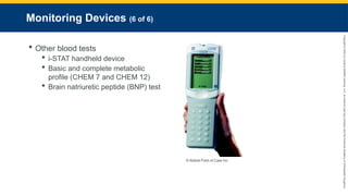 Copyright
©
2023
by
Jones
&
Bartlett
Learning,
LLC,
an
Ascend
Learning
Company
and
the
American
Academy
of
Orthopaedic
Surgeons.
Monitoring Devices (6 of 6)
 Other blood tests
 i-STAT handheld device
 Basic and complete metabolic
profile (CHEM 7 and CHEM 12)
 Brain natriuretic peptide (BNP) test
© Abbott Point of Care Inc.
 