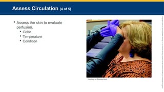 Copyright
©
2023
by
Jones
&
Bartlett
Learning,
LLC,
an
Ascend
Learning
Company
and
the
American
Academy
of
Orthopaedic
Surgeons.
Assess Circulation (4 of 5)
 Assess the skin to evaluate
perfusion.
 Color
 Temperature
 Condition
Courtesy of Rhonda Hunt.
 
