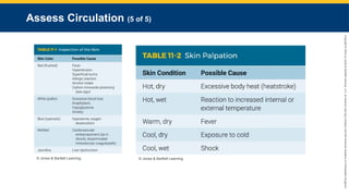 Copyright
©
2023
by
Jones
&
Bartlett
Learning,
LLC,
an
Ascend
Learning
Company
and
the
American
Academy
of
Orthopaedic
Surgeons.
Assess Circulation (5 of 5)
© Jones & Bartlett Learning. © Jones & Bartlett Learning.
 