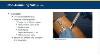 Copyright
©
2023
by
Jones
&
Bartlett
Learning,
LLC,
an
Ascend
Learning
Company
and
the
American
Academy
of
Orthopaedic
Surgeons.
Non-Tunneling VAD (2 of 4)
 To access:
 Use aseptic technique.
 Prepare the equipment:
 Empty 10- to 20-mL syringe
 10-mL normal saline flush
 Sterile gloves
 Alcohol prep
 10-gttt administration set
 500 mL normal saline
 Ensure all lumens are clamped
and cleansed.
© Jones & Bartlett Learning.
 