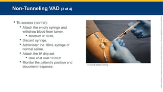 Copyright
©
2023
by
Jones
&
Bartlett
Learning,
LLC,
an
Ascend
Learning
Company
and
the
American
Academy
of
Orthopaedic
Surgeons.
Non-Tunneling VAD (3 of 4)
 To access (cont’d):
 Attach the empty syringe and
withdraw blood from lumen.
 Minimum of 10 mL
 Discard syringe.
 Administer the 10mL syringe of
normal saline.
 Attach the IV drip set.
 Rate of at least 10 mL/h
 Monitor the patient’s position and
document response.
© Jones & Bartlett Learning.
 