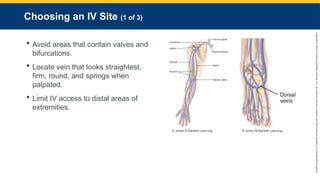 Copyright
©
2023
by
Jones
&
Bartlett
Learning,
LLC,
an
Ascend
Learning
Company
and
the
American
Academy
of
Orthopaedic
Surgeons.
Choosing an IV Site (1 of 3)
 Avoid areas that contain valves and
bifurcations.
 Locate vein that looks straightest,
firm, round, and springs when
palpated.
 Limit IV access to distal areas of
extremities.
© Jones & Bartlett Learning. © Jones & Bartlett Learning.
 