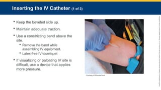 Copyright
©
2023
by
Jones
&
Bartlett
Learning,
LLC,
an
Ascend
Learning
Company
and
the
American
Academy
of
Orthopaedic
Surgeons.
Inserting the IV Catheter (1 of 3)
 Keep the beveled side up.
 Maintain adequate traction.
 Use a constricting band above the
site.
 Remove the band while
assembling IV equipment.
 Latex-free IV tourniquet
 If visualizing or palpating IV site is
difficult, use a device that applies
more pressure.
Courtesy of Rhonda Hunt.
 
