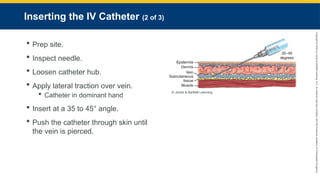 Copyright
©
2023
by
Jones
&
Bartlett
Learning,
LLC,
an
Ascend
Learning
Company
and
the
American
Academy
of
Orthopaedic
Surgeons.
Inserting the IV Catheter (2 of 3)
 Prep site.
 Inspect needle.
 Loosen catheter hub.
 Apply lateral traction over vein.
 Catheter in dominant hand
 Insert at a 35 to 45° angle.
 Push the catheter through skin until
the vein is pierced.
© Jones & Bartlett Learning.
 