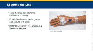 Copyright
©
2023
by
Jones
&
Bartlett
Learning,
LLC,
an
Ascend
Learning
Company
and
the
American
Academy
of
Orthopaedic
Surgeons.
Securing the Line
 Tape the area to secure the
catheter and tubing.
 Cover the site with sterile gauze
and secure with tape.
 Refer to Skill Drill 14-1: Obtaining
Vascular Access
© GracePhotos/Shutterstock.
 