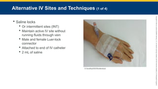 Copyright
©
2023
by
Jones
&
Bartlett
Learning,
LLC,
an
Ascend
Learning
Company
and
the
American
Academy
of
Orthopaedic
Surgeons.
Alternative IV Sites and Techniques (1 of 4)
 Saline locks
 Or intermittent sites (INT)
 Maintain active IV site without
running fluids through vein
 Male and female Luer-lock
connector
 Attached to end of IV catheter
 2 mL of saline
© SoraSky0303/Shutterstock.
 