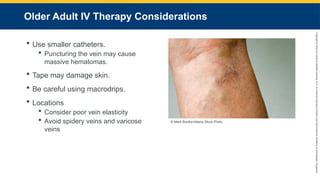 Copyright
©
2023
by
Jones
&
Bartlett
Learning,
LLC,
an
Ascend
Learning
Company
and
the
American
Academy
of
Orthopaedic
Surgeons.
Older Adult IV Therapy Considerations
 Use smaller catheters.
 Puncturing the vein may cause
massive hematomas.
 Tape may damage skin.
 Be careful using macrodrips.
 Locations
 Consider poor vein elasticity
 Avoid spidery veins and varicose
veins
© Mark Boulton/Alamy Stock Photo.
 