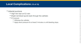 Copyright
©
2023
by
Jones
&
Bartlett
Learning,
LLC,
an
Ascend
Learning
Company
and
the
American
Academy
of
Orthopaedic
Surgeons.
Local Complications (15 of 15)
 Arterial puncture
 High risk near an EJ vein
 Bright red blood spurts back through the catheter.
 If it occurs:
 Withdraw the catheter.
 Apply direct pressure for at least 5 minutes or until bleeding stops.
 