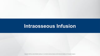 Copyright © 2023 by Jones & Bartlett Learning, LLC, an Ascend Learning Company and the American Academy of Orthopaedic Surgeons.
Intraosseous Infusion
 