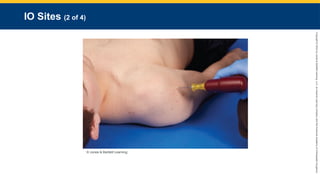 Copyright
©
2023
by
Jones
&
Bartlett
Learning,
LLC,
an
Ascend
Learning
Company
and
the
American
Academy
of
Orthopaedic
Surgeons.
IO Sites (2 of 4)
© Jones & Bartlett Learning.
 