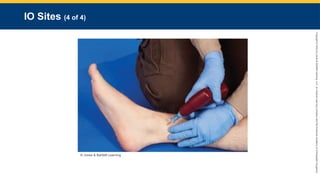 Copyright
©
2023
by
Jones
&
Bartlett
Learning,
LLC,
an
Ascend
Learning
Company
and
the
American
Academy
of
Orthopaedic
Surgeons.
IO Sites (4 of 4)
© Jones & Bartlett Learning
 