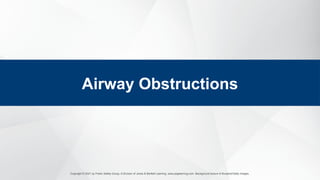 Copyright © 2021 by Public Safety Group, A Division of Jones & Bartlett Learning. www.psglearning.com. Background texture © Bunphot/Getty Images.
Airway Obstructions
 
