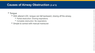 Copyright
©
2023
by
Jones
&
Bartlett
Learning,
LLC,
an
Ascend
Learning
Company
and
the
American
Academy
of
Orthopaedic
Surgeons.
Causes of Airway Obstruction (2 of 3)
 Tongue
 With altered LOC, tongue can fall backward, closing off the airway.
 Partial obstruction: Snoring respirations
 Complete obstruction: No respirations
 Simple to correct with manual maneuver
 