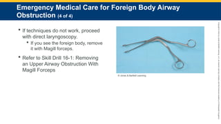 Copyright
©
2023
by
Jones
&
Bartlett
Learning,
LLC,
an
Ascend
Learning
Company
and
the
American
Academy
of
Orthopaedic
Surgeons.
Emergency Medical Care for Foreign Body Airway
Obstruction (4 of 4)
 If techniques do not work, proceed
with direct laryngoscopy.
 If you see the foreign body, remove
it with Magill forceps.
 Refer to Skill Drill 16-1: Removing
an Upper Airway Obstruction With
Magill Forceps
© Jones & Bartlett Learning.
 