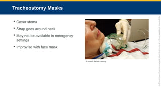 Copyright
©
2023
by
Jones
&
Bartlett
Learning,
LLC,
an
Ascend
Learning
Company
and
the
American
Academy
of
Orthopaedic
Surgeons.
Tracheostomy Masks
 Cover stoma
 Strap goes around neck
 May not be available in emergency
settings
 Improvise with face mask
© Jones & Bartlett Learning.
 
