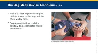 Copyright
©
2023
by
Jones
&
Bartlett
Learning,
LLC,
an
Ascend
Learning
Company
and
the
American
Academy
of
Orthopaedic
Surgeons.
The Bag-Mask Device Technique (2 of 6)
 Hold the mask in place while your
partner squeezes the bag until the
chest visibly rises.
 Squeeze every 6 seconds for
adults, 2 to 3 seconds for infants
and children.
© Jones & Bartlett Learning. Courtesy of MIEMSS.
 