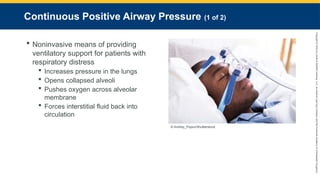 Copyright
©
2023
by
Jones
&
Bartlett
Learning,
LLC,
an
Ascend
Learning
Company
and
the
American
Academy
of
Orthopaedic
Surgeons.
Continuous Positive Airway Pressure (1 of 2)
 Noninvasive means of providing
ventilatory support for patients with
respiratory distress
 Increases pressure in the lungs
 Opens collapsed alveoli
 Pushes oxygen across alveolar
membrane
 Forces interstitial fluid back into
circulation
© Andrey_Popov/Shutterstock.
 